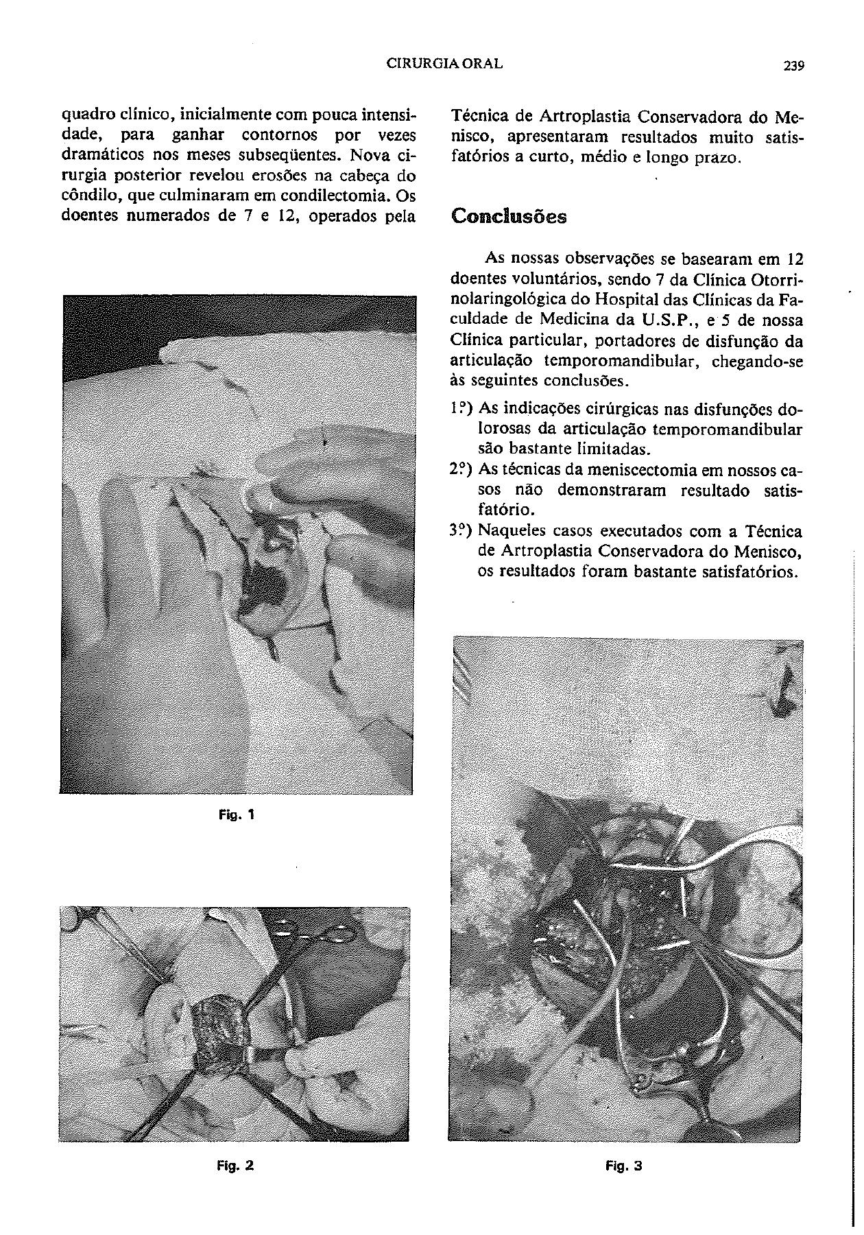 Original article page showing operative photographs from conservative TMJ arthroplasty